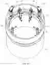 Fig. 15 - LIFTING SYSTEM FOR A ROTOR BLADE OF A WIND TURBINE