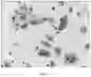 Fig. 02 - A METHOD FOR MULTIPLE STAINING AND SLIDE PREPARATION FOR A CYTOPATHOLOGICAL SAMPLE