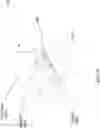 Fig. 33 - Suppression of stray light in head worn computing