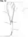 Fig. 11 - Leash with flexible bag dispenser pocket