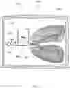 Fig. 07 - APPARATUS FOR TISSUE TRANSPORT AND PRESERVATION