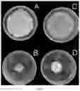 Fig. 07 - BACILLUS VELEZENSIS, FERMENTATION METHOD, FERMENTATION PRODUCT AND ITS APPLICATION