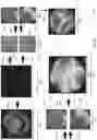 Fig. 09 - Ocular aberrometry recovery systems and methods