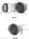 Fig. 09 - IMAGING SYSTEM AND DEVICE FOR BREAST CANCER DETECTION