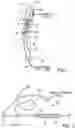 Fig. 02 - PERFUSION DEVICE FOR A BLOOD VESSEL