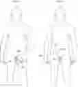Fig. 02 - Implant Comprising an expandable section