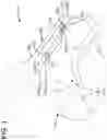 Fig. 02 - LAMINOPLASTY IMPLANT SYSTEMS AND METHODS
