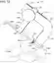 Fig. 14 - LAMINOPLASTY IMPLANT SYSTEMS AND METHODS