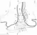 Fig. 02 - OCCLUSION DEVICE CAPABLE OF OCCLUDING AN EAR CANAL