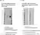 Fig. 09 - COMPOSITION COMPRISING ANTIGEN-PRESENTING CELL CO-EXPRESSING MHC AND TUMOR ANTIGEN, AND CANCER TREATMENT USING SAME