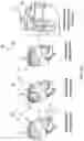 Fig. 25 - Methods of using planar or defocused acoustic waves for non-invasive sonodynamic therapy