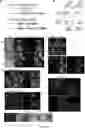 Fig. 10 - METHOD FOR DIFFERENTIATING PLURIPOTENT STEM CELLS INTO DOPAMINERGIC NERVE CELLS IN MIDBRAIN SUBSTANTIA NIGRA