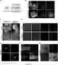 Fig. 14 - METHOD FOR DIFFERENTIATING PLURIPOTENT STEM CELLS INTO DOPAMINERGIC NERVE CELLS IN MIDBRAIN SUBSTANTIA NIGRA