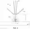 Fig. 04 - Reduced charging by low negative voltage in FIB systems