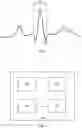 Fig. 02 - DEVICE AND SYSTEM FOR DETECTING HEART RHYTHM ABNORMALITIES