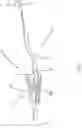 Fig. 02 - WEDGE LOCK NEEDLE HOLDER