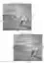Fig. 45 - APPARATUS AND METHOD FOR LOCALIZED HYPOTHERMIA OF THE PANCREAS