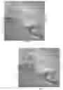 Fig. 43 - Apparatus and method for cooling and/or heating an organ