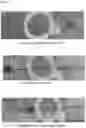 Fig. 06 - Surface processing method and structure