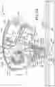 Fig. 13 - Insert for palm stapler, a palm stapler and a method of use thereof