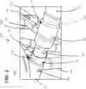 Fig. 03 - Wheelbarrow and kit for assembling same