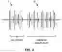 Fig. 03 - Method and system for acoustic model conditioning on non-phoneme information features