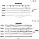 Fig. 37 - SYSTEMS AND METHODS TO EVALUATE DRUG-INDUCED GASTROINTESTINAL DYSRHYTHMIA