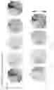Fig. 43 - SYSTEMS AND METHODS TO EVALUATE DRUG-INDUCED GASTROINTESTINAL DYSRHYTHMIA