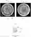 Fig. 05 - ENCAPSULATED OPTO-ELECTRONIC SYSTEM FOR CO-DIRECTIONAL IMAGING IN MULTIPLE FIELDS OF VIEW