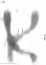 Fig. 09 - ASSESSING DISEASES BY ANALYZING GAIT MEASUREMENTS