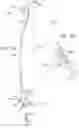 Fig. 02 - SUTURING WITH AN ENDOLUMINAL GASTROPLASTY DEVICE