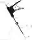 Fig. 02 - SURGICAL GUIDE AND FIXATION INSERTION DEVICE