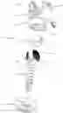 Fig. 01 - Spinal Fixation System