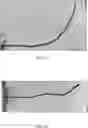 Fig. 07 - Systems and methods for three dimensional reconstruction of a bent rod used in surgery