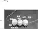 Fig. 01 - PONTIC WITH ARCHWIRE CONNECTION