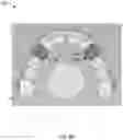 Fig. 07 - PONTIC WITH ARCHWIRE CONNECTION