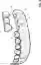 Fig. 06 - METHOD FOR DYNAMICALLY GUIDING A DENTAL ORAL AND MAXILLOFACIAL PROSTHESIS USING A 3D DATASET