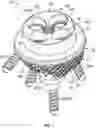 Fig. 02 - Orthopaedic implants including breakaway fastener