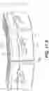 Fig. 45 - Coiling implantable prostheses and methods for implanting