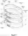 Fig. 02 - Orthosis for deformity correction