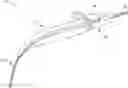 Fig. 01 - SUB-RETINAL TANGENTIAL NEEDLE CATHETER GUIDE AND INTRODUCER