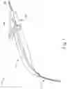 Fig. 02 - SUB-RETINAL TANGENTIAL NEEDLE CATHETER GUIDE AND INTRODUCER
