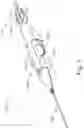 Fig. 08 - SUB-RETINAL TANGENTIAL NEEDLE CATHETER GUIDE AND INTRODUCER