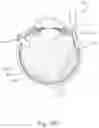 Fig. 22 - SUB-RETINAL TANGENTIAL NEEDLE CATHETER GUIDE AND INTRODUCER