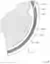 Fig. 77 - SUB-RETINAL TANGENTIAL NEEDLE CATHETER GUIDE AND INTRODUCER