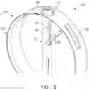 Fig. 04 - CAPSULORHEXIS APPARATUS AND METHOD