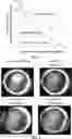 Fig. 07 - COMPOSITIONS AND METHODS FOR TREATING AND/OR PREVENTING OCULAR DISORDERS