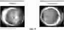 Fig. 08 - COMPOSITIONS AND METHODS FOR TREATING AND/OR PREVENTING OCULAR DISORDERS