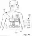 Fig. 89 - METHODS AND DEVICES FOR SECURE COMMUNICATION WITH AND OPERATION OF AN IMPLANT