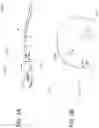 Fig. 02 - LESS INVASIVE AND IMPROVED PERIPHERAL NERVE STIMULATORS FOR OBSTRUCTIVE SLEEP APNEA AND OTHER APPLICATIONS